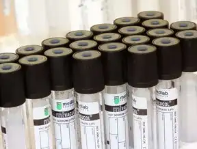 测试压力仪器的应用与选择指南，测试压力的仪器有哪些