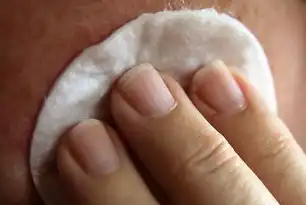 静脉治疗并发症临床实践指南，预防策略与多学科协作处理体系，静脉治疗相关并发症的预防及护理